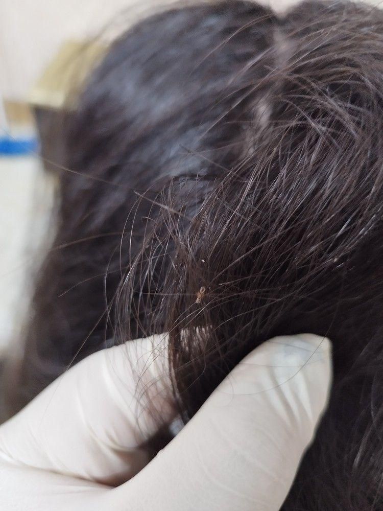 مرکز تخصصی درمان رشک و شپش Ramezani|خدمات آرایشگری و زیبایی|مشهد, ایثار|دیوار