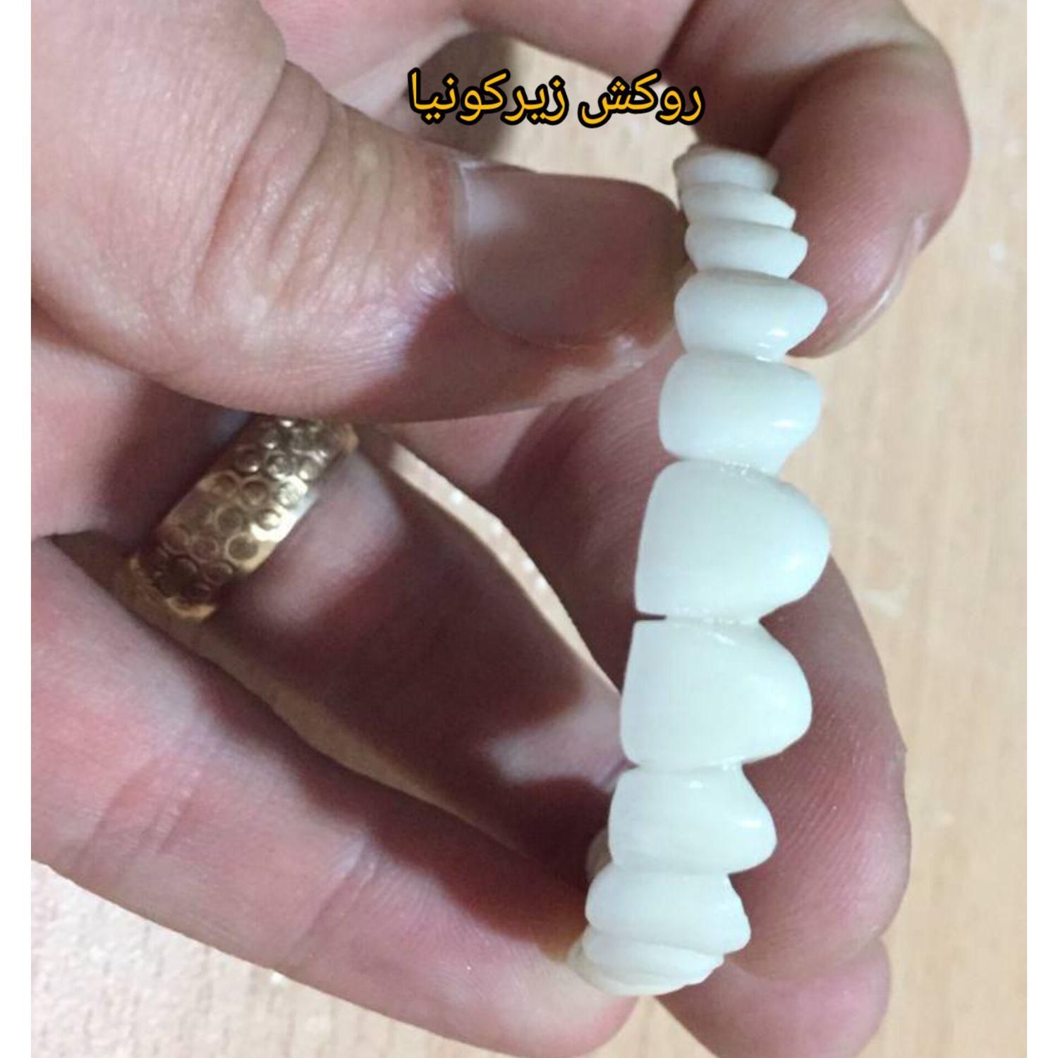 کلینیک تخصصی روکش و روکش ایمپلنت با تضمین کیفیت|خدمات آرایشگری و زیبایی|تبریز, |دیوار