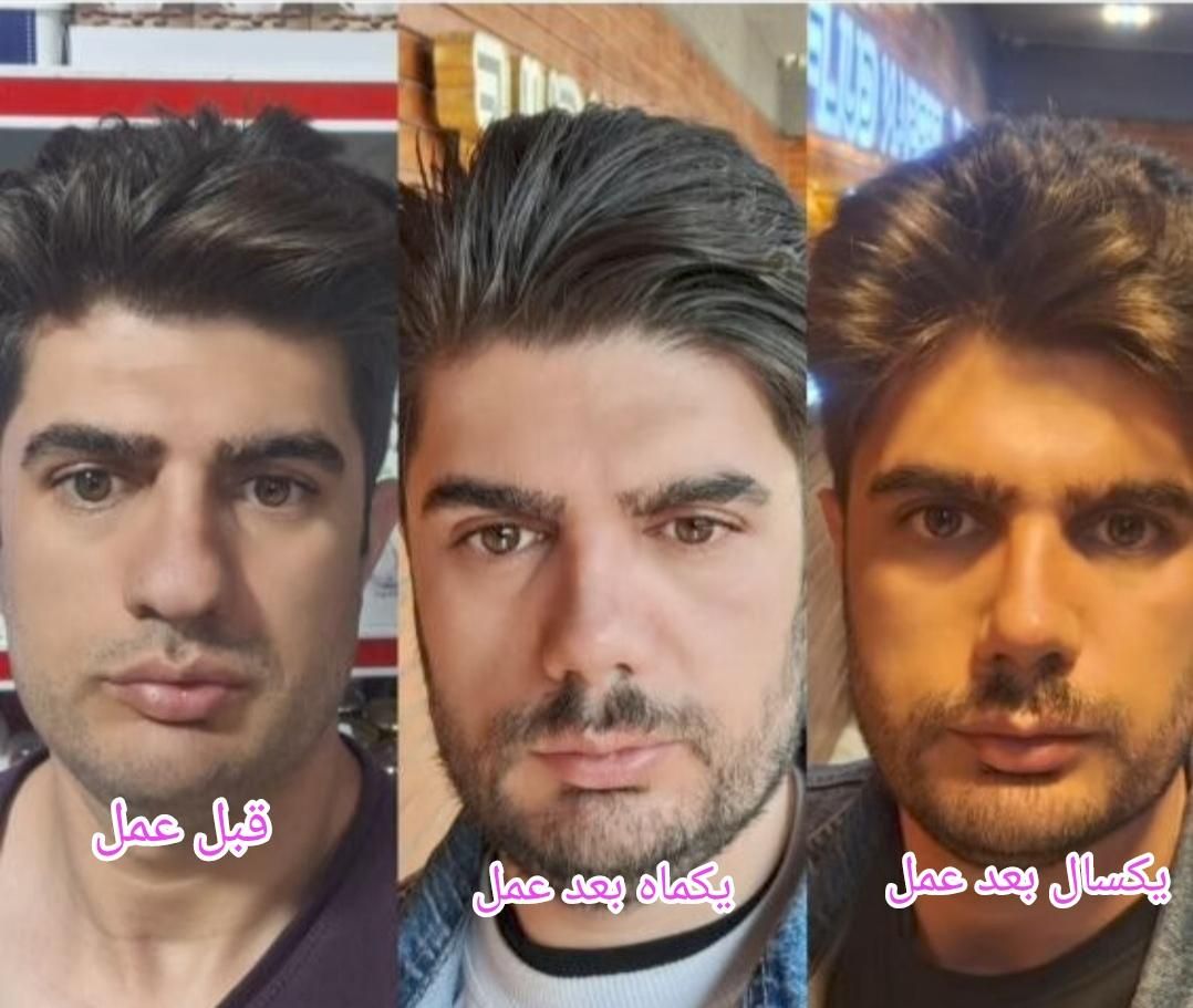 عمل جراحی بینی بامتخصص گوش،حلق،بینی|خدمات آرایشگری و زیبایی|تهران, ونک|دیوار