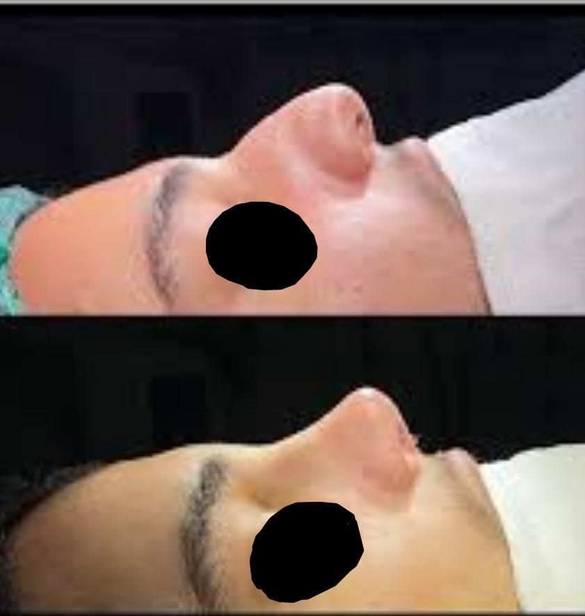 جراحی زیبایی بینی (جشواره)|خدمات آرایشگری و زیبایی|تهران, صادقیه|دیوار