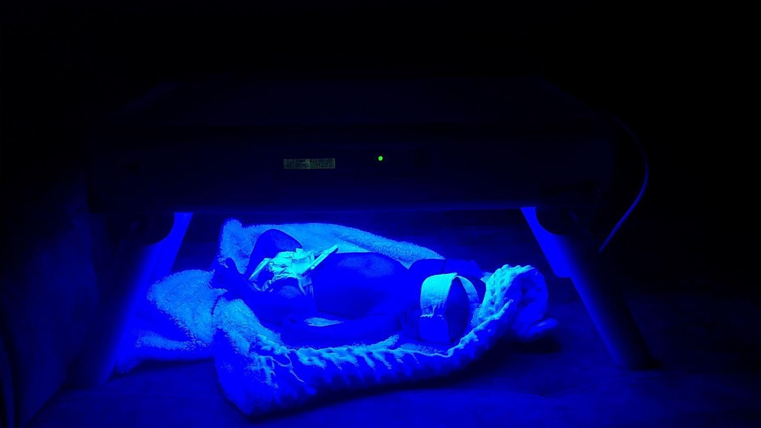 اجاره و درمان زردی نوزاد درفردیس|خدمات آرایشگری و زیبایی|فردیس, شهرک ۱۱۰|دیوار