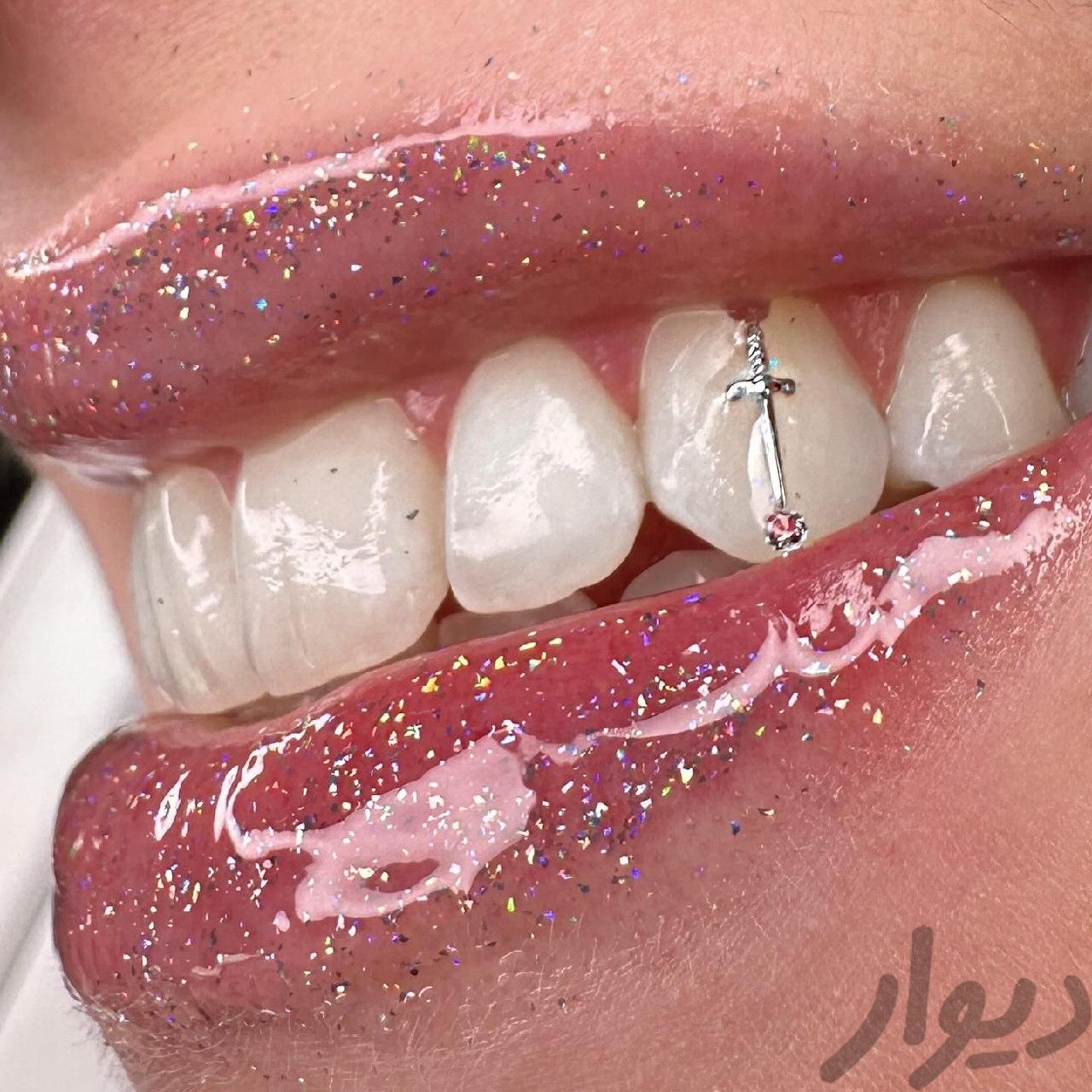 جشنواره خدمات دندانپزشکی کامپوزیت ایمپلنت|خدمات آرایشگری و زیبایی|تهران, دردشت|دیوار