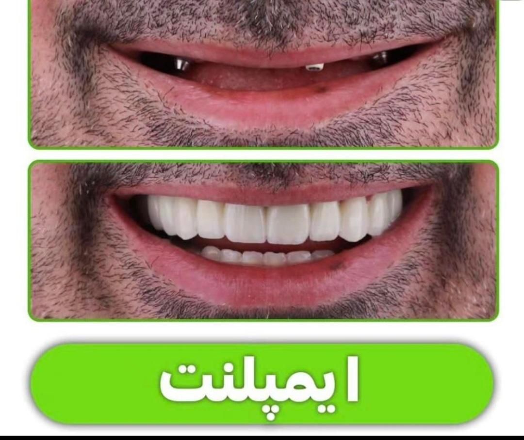دندانپزشکی نقد و اقساط باتخفیفات بینظیر دندانپزشکی|خدمات آرایشگری و زیبایی|شیراز, قصرالدشت|دیوار