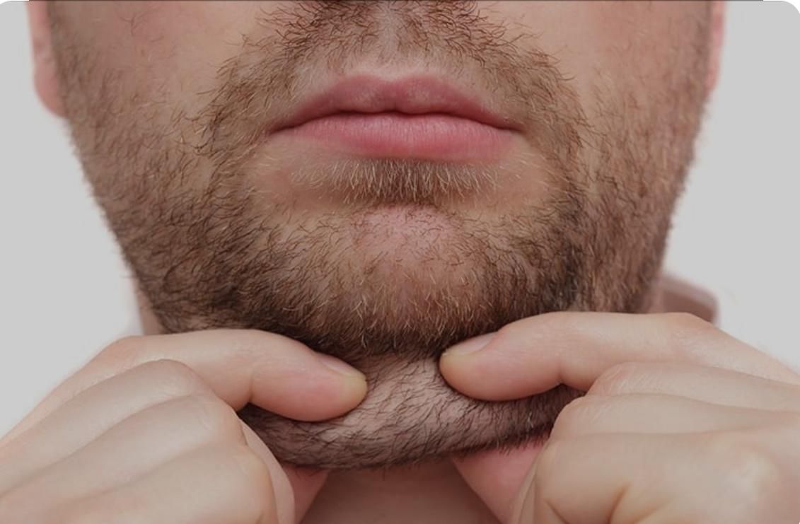 تزریق چربی صورت و جراحی لاغری(ابدو)و بلفاروپلاستی|خدمات آرایشگری و زیبایی|اصفهان, سیچان|دیوار