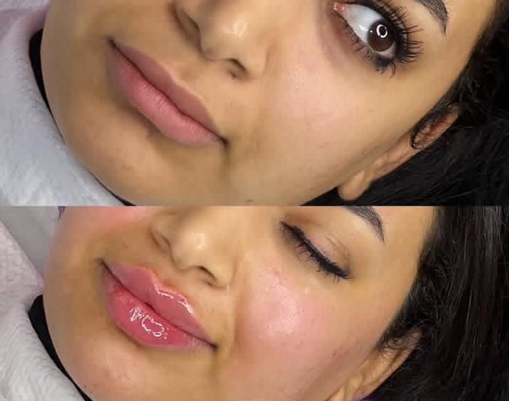 آموزش و انجام خدمات پوست و مو ژل و بوتاکس و..|خدمات آرایشگری و زیبایی|نور, |دیوار