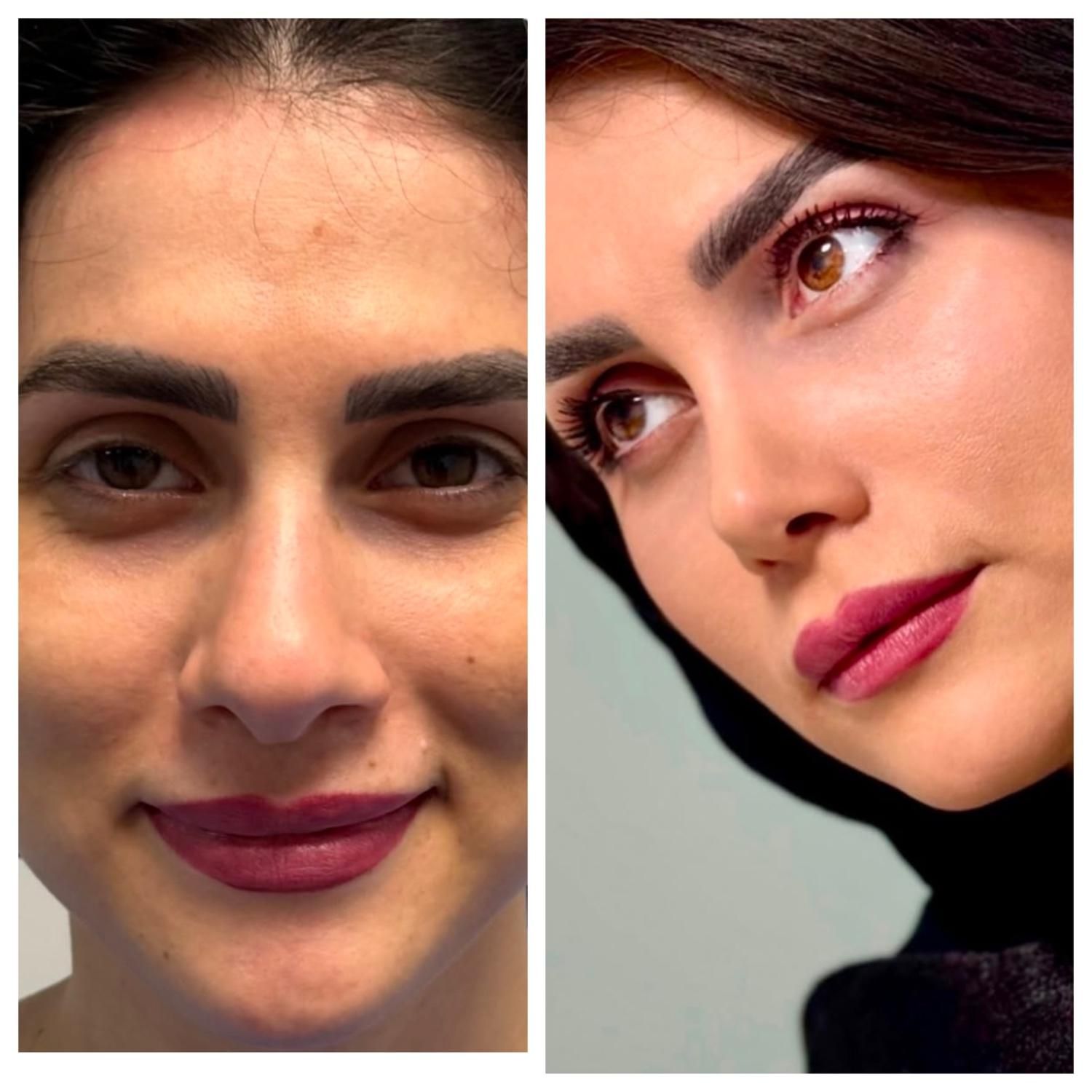 جراحی زیبائی بینی عمل بینی لیفت شقیقه پلک گوش غبغب|خدمات آرایشگری و زیبایی|اصفهان, مرداویج|دیوار