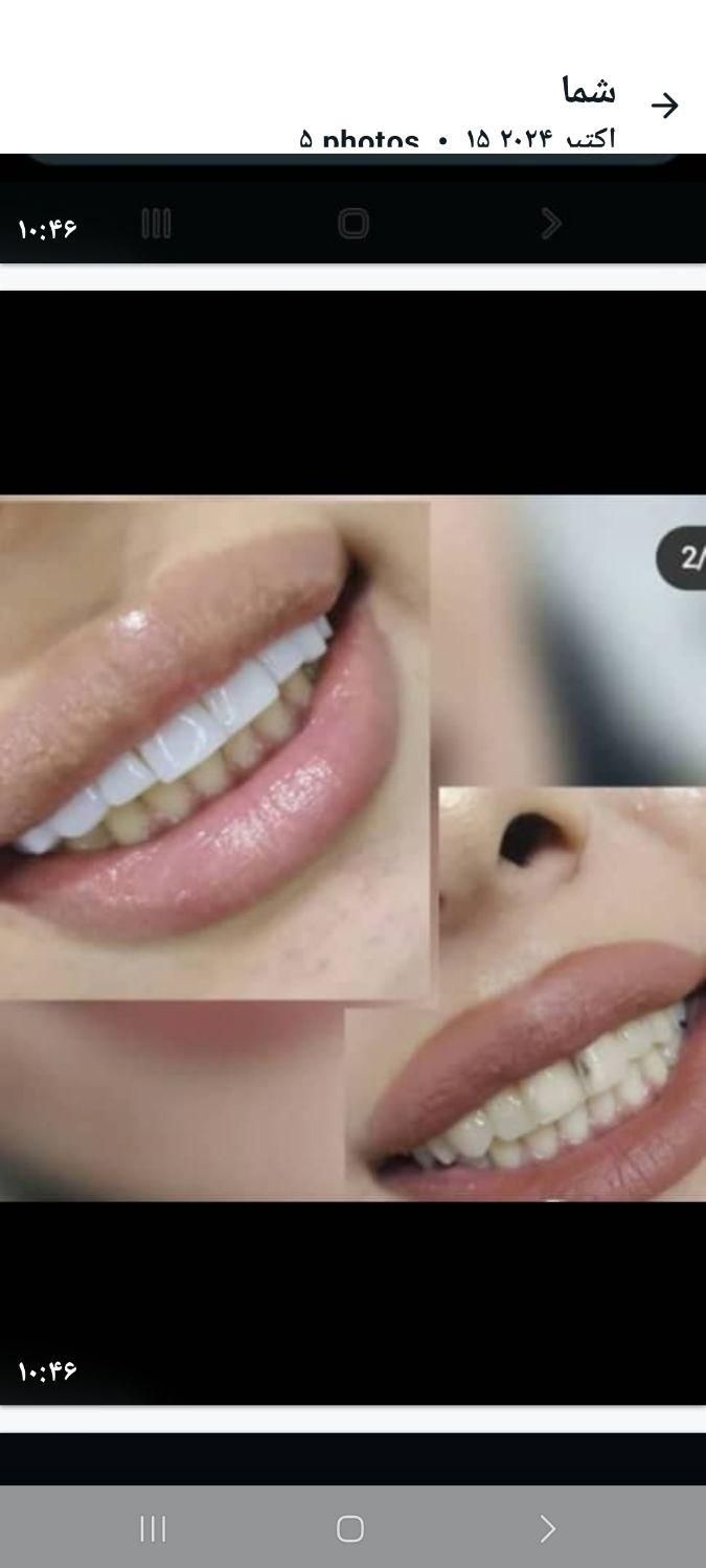 دندانپزشکی مهر با تخفیف‌های ویژه|خدمات آرایشگری و زیبایی|تهران, جنت‌آباد جنوبی|دیوار