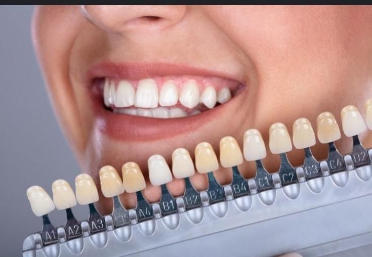 تخفیف ویژه کامپوزیت و لمینت با بهترین متخصصان|خدمات آرایشگری و زیبایی|شیراز, فرهنگ شهر|دیوار