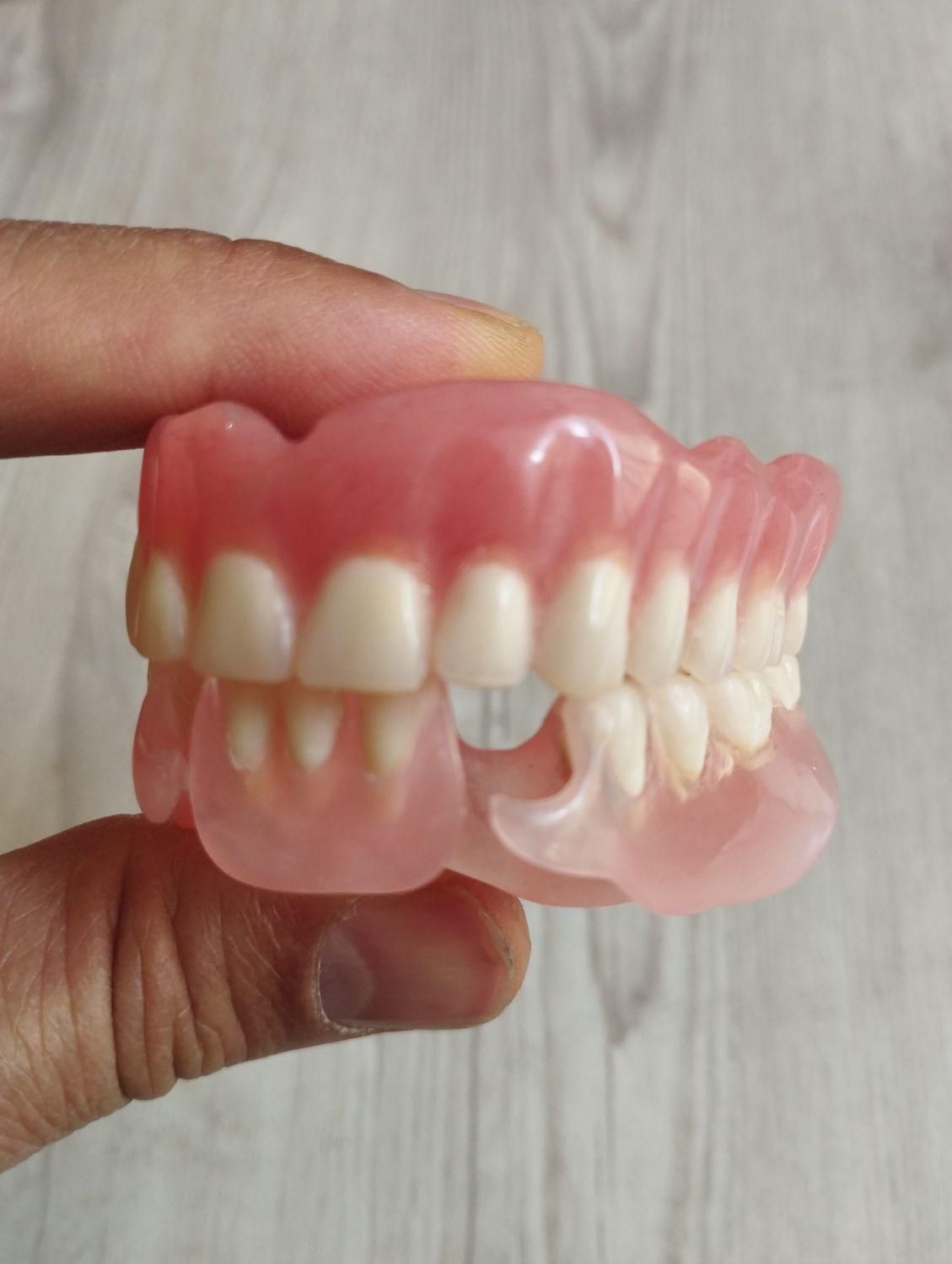 ساخت دست دندان و رفع لقی و شکستگی|خدمات آرایشگری و زیبایی|تهران, سبلان (لشگر)|دیوار