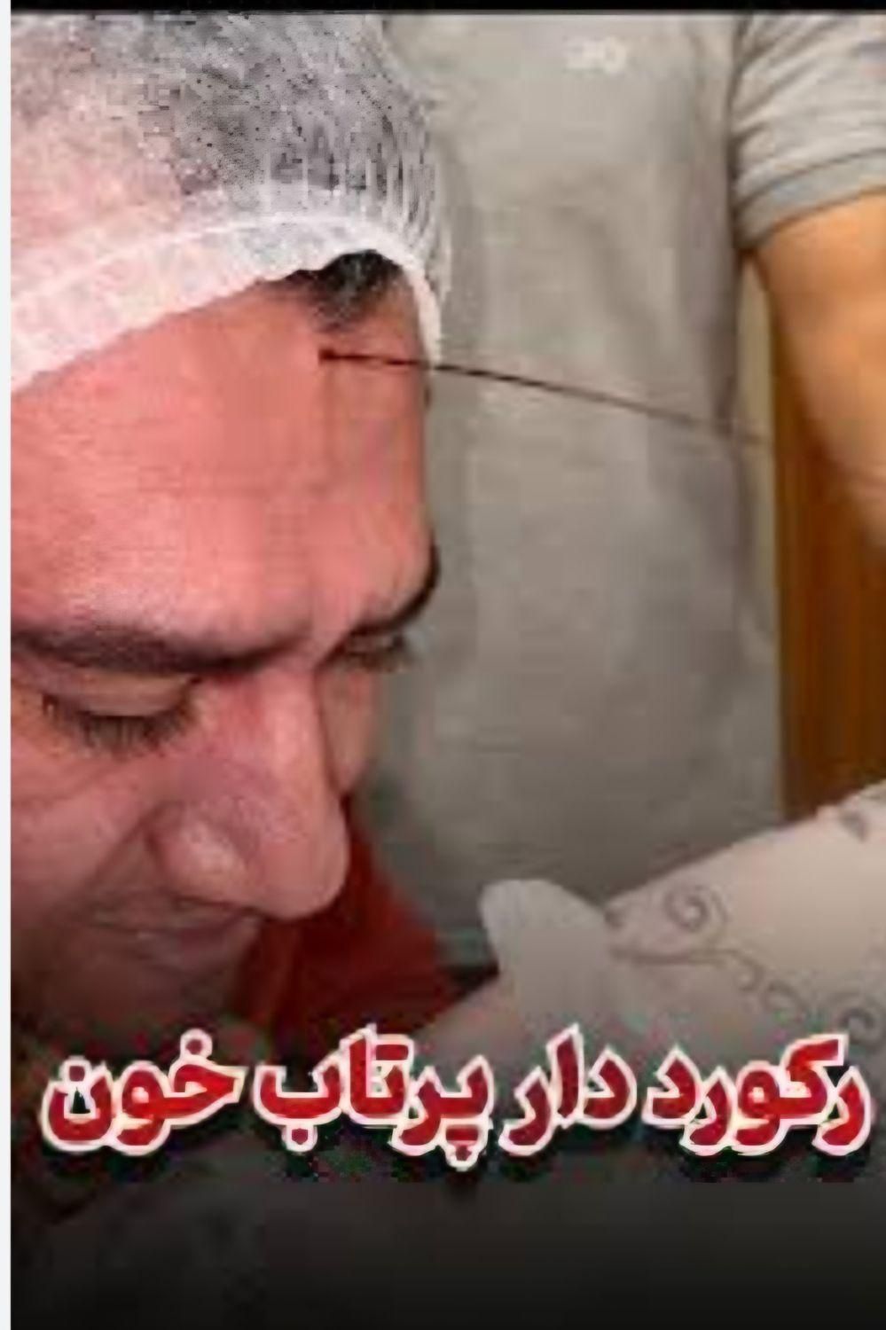 زالو،حجامت،فصد خون،مشاوره طب سنتی عباسیه نجف آباد|خدمات آرایشگری و زیبایی|یزد, |دیوار