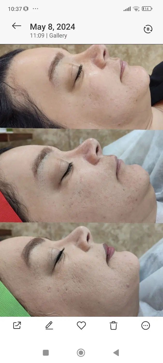 آموزش پاکسازی صورت و دست|خدمات آموزشی|تهران, کن|دیوار