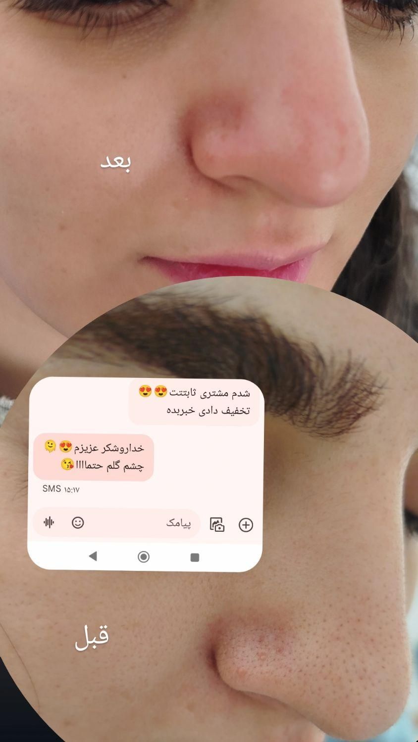 فیشیال تخصصی پوست|خدمات آرایشگری و زیبایی|گلبهار, |دیوار