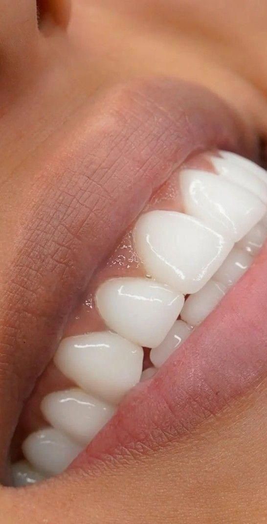 دندانپزشکی/ هدیه ویژه مراجعین جدید|خدمات آرایشگری و زیبایی|رباط‌کریم, |دیوار