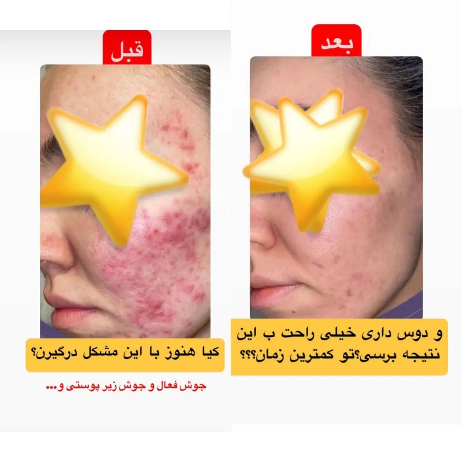 دخترا فروزان رو‌ب اتمام|آرایشی، بهداشتی، درمانی|تهران, هروی|دیوار