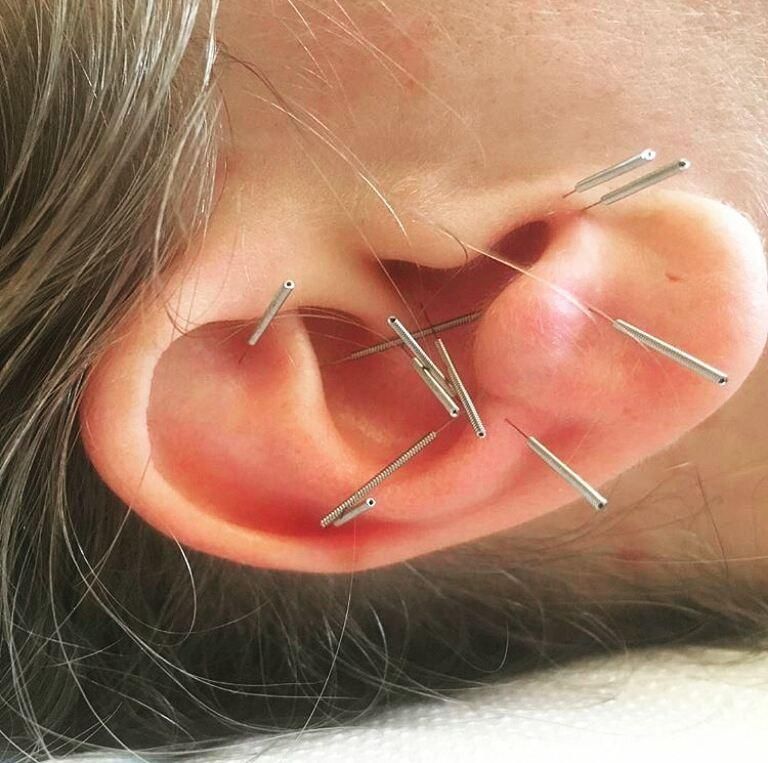 امبدینگ موکساتراپی حجامت طب سوزنی بادکش فصد|خدمات آرایشگری و زیبایی|اصفهان, شهریار|دیوار