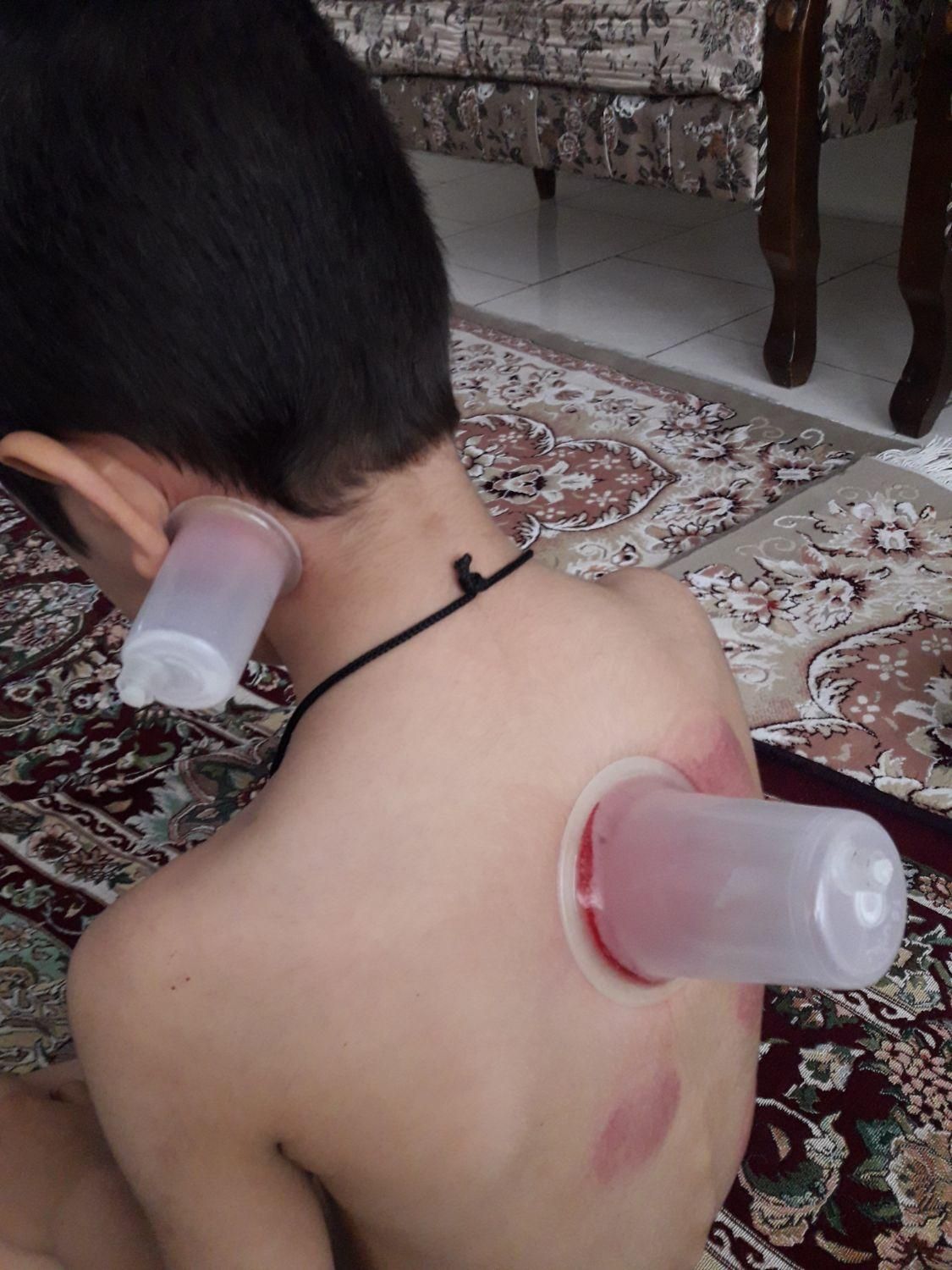 حجامت وبادکش|خدمات آرایشگری و زیبایی|ماهدشت, |دیوار