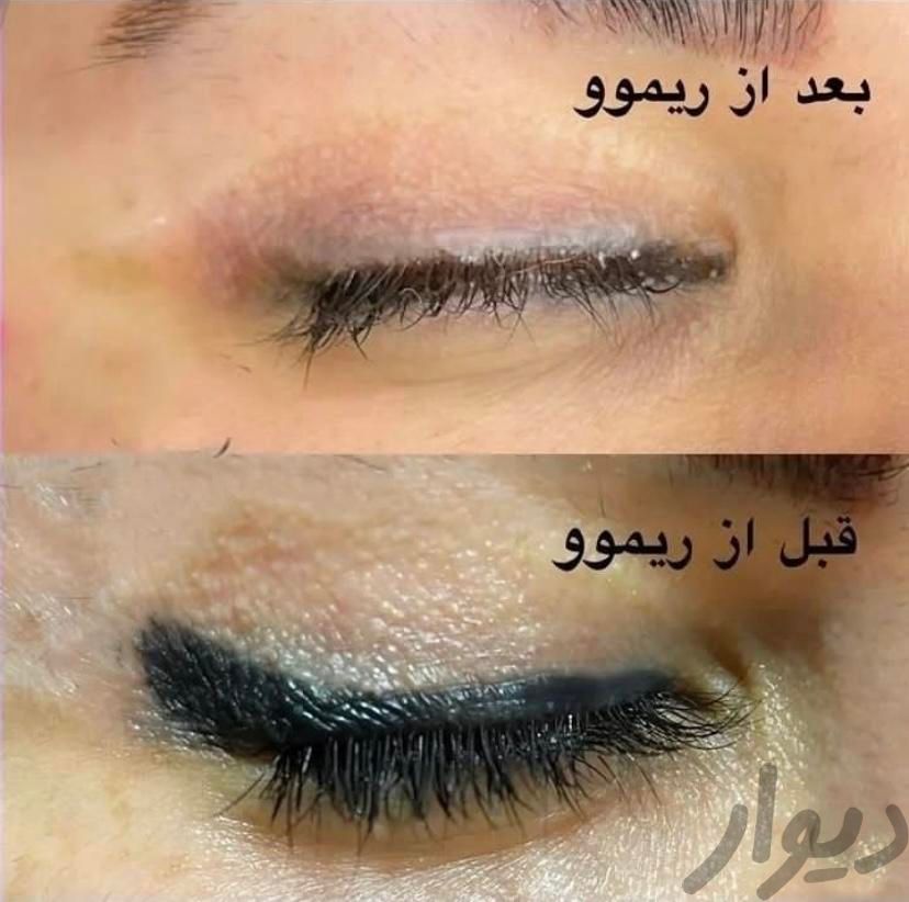 ریموو و پاک کردن انواع تتو صورت(ابرو چشم و لب)|خدمات آرایشگری و زیبایی|تهران, گرگان|دیوار