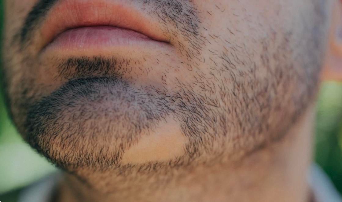 کلینیک زیبایی خیابان ادب|خدمات آرایشگری و زیبایی|سنندج, |دیوار