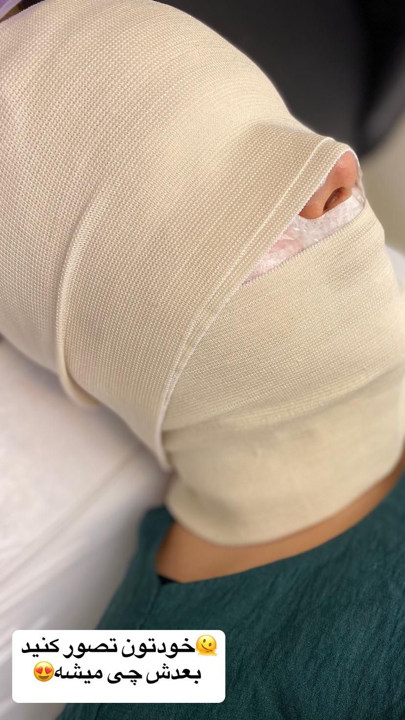 آموزش و خدمات فـیـشـیال و پــاکسـازی از ۴۰۰ تا ۸۰۰|خدمات آرایشگری و زیبایی|اهواز, کیانپارس |دیوار