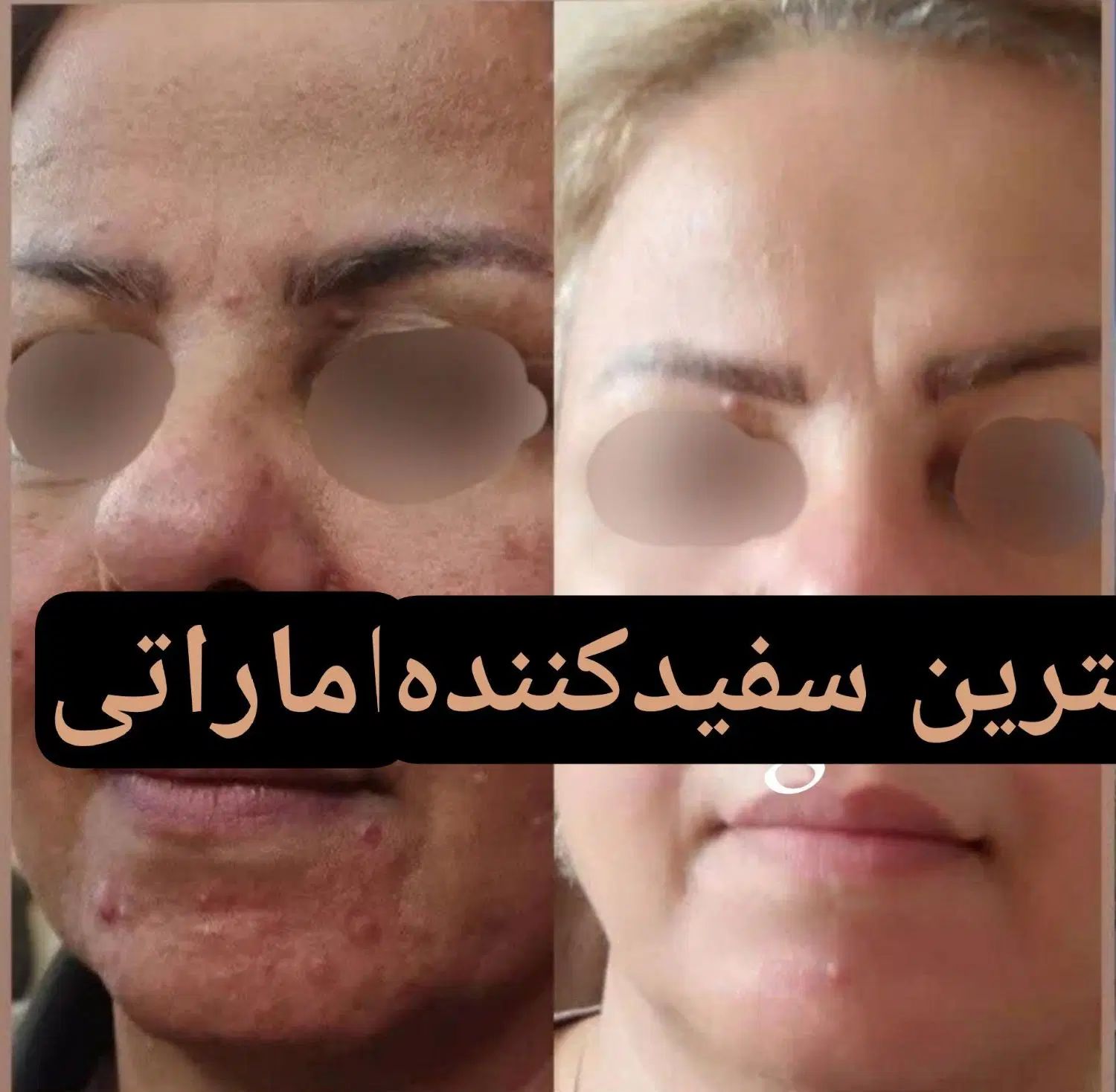 دخترا فروزان رو‌ب اتمام|آرایشی، بهداشتی، درمانی|تهران, هروی|دیوار