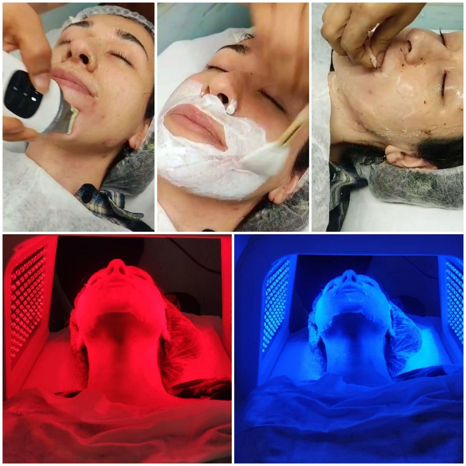 مدل فیشال و پاکسازی پوست|خدمات آرایشگری و زیبایی|تهران, سبلان (لشگر)|دیوار