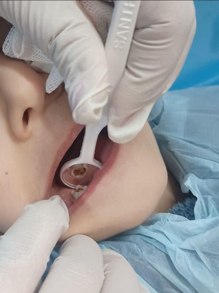 دندانپزشکی اطفال کودک‌ و نوجوان فردیس کرج|خدمات آرایشگری و زیبایی|فردیس, فردیس|دیوار