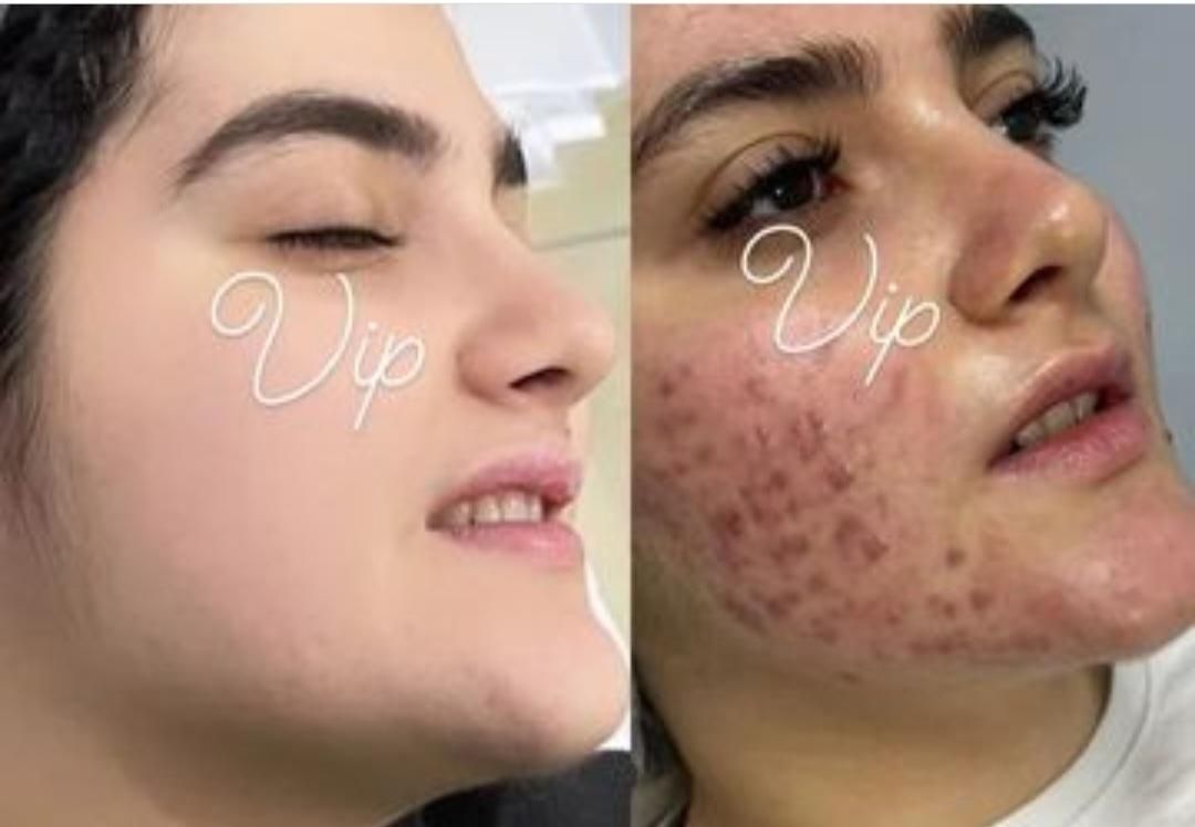 کرم سفید کننده ی عروس بندر|آرایشی، بهداشتی، درمانی|بندرعباس, |دیوار