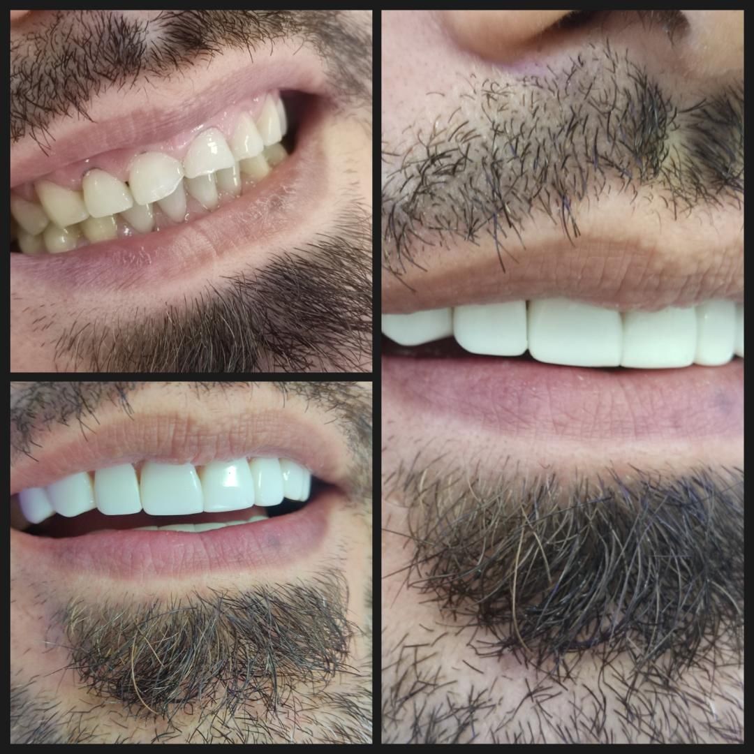 جشنواره یک روزه کامپوزیت در تهران|خدمات آرایشگری و زیبایی|پاکدشت, شهرک امام رضا|دیوار