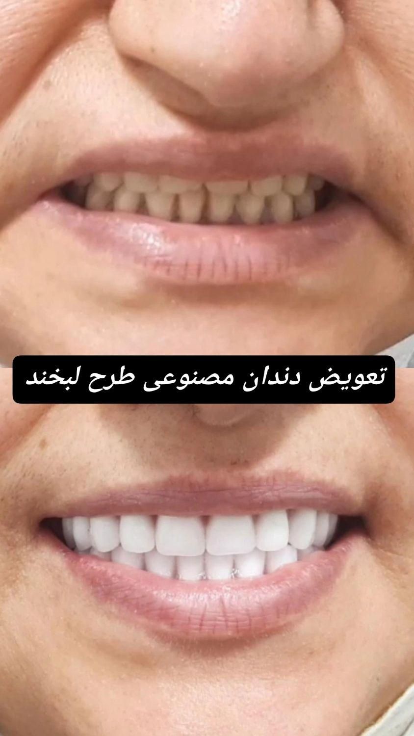 دندانپزشکی و دندانسازی پارسیان|خدمات آرایشگری و زیبایی|نسیمشهر, |دیوار