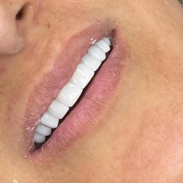 دندانپزشکی.لمینت.ایمپلنت.|خدمات آرایشگری و زیبایی|اصفهان, جلفا|دیوار