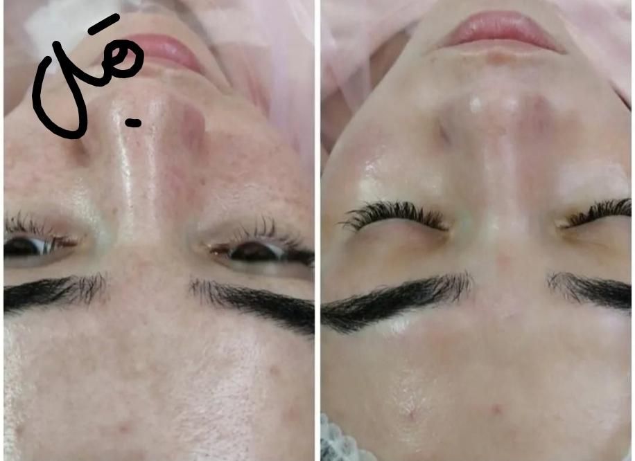 تکنیک مزووایت(روشن کننده پوست) کرمپودر دائم|خدمات آرایشگری و زیبایی|لاهیجان, انقلاب|دیوار