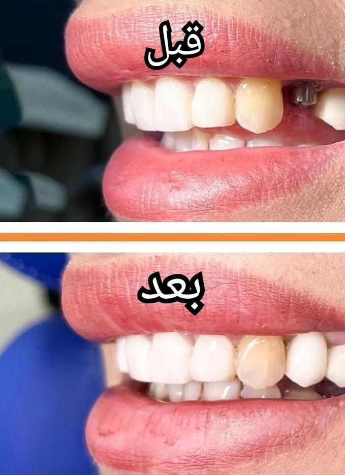 دندانپزشکی دکتر محمد ناصری|خدمات آرایشگری و زیبایی|کرمانشاه, |دیوار