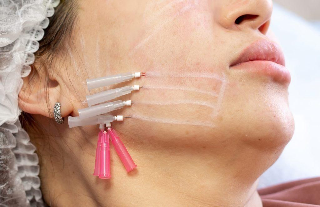 تخفیفات ویژه/اگزوزوم/مزو ژل/لیفتینگ/فشیال تخصصی|خدمات آرایشگری و زیبایی|شیراز, وحدت|دیوار