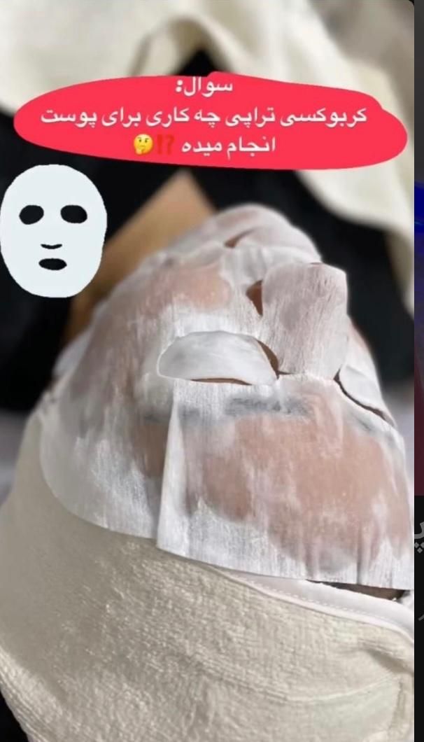 پاکسازی پوست (فقط کافیه یکبار پیش ما انجام بدین)|خدمات آرایشگری و زیبایی|رشت, قاسمیه|دیوار