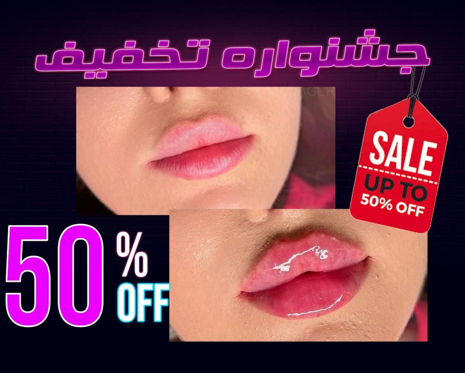 تخفیف تزریق ژل بوتاکس هایفولیزر فیلربادی لیفت بانخ|خدمات آرایشگری و زیبایی|تهران, ستارخان|دیوار