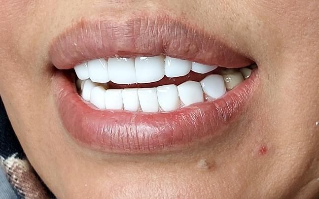 کامپوزیت زیبایی|خدمات آرایشگری و زیبایی|اسلام‌شهر, شهرک قائمیه|دیوار