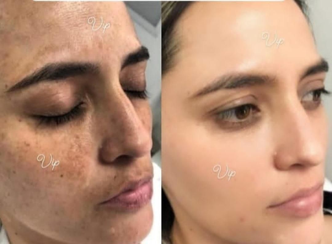 کرم سفید کننده ی عروس بندر|آرایشی، بهداشتی، درمانی|بندرعباس, |دیوار