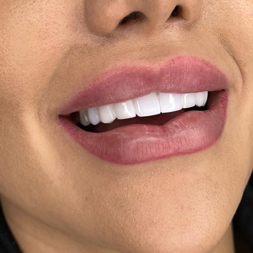 دندانپزشکی.لمینت.ایمپلنت.|خدمات آرایشگری و زیبایی|اصفهان, جلفا|دیوار