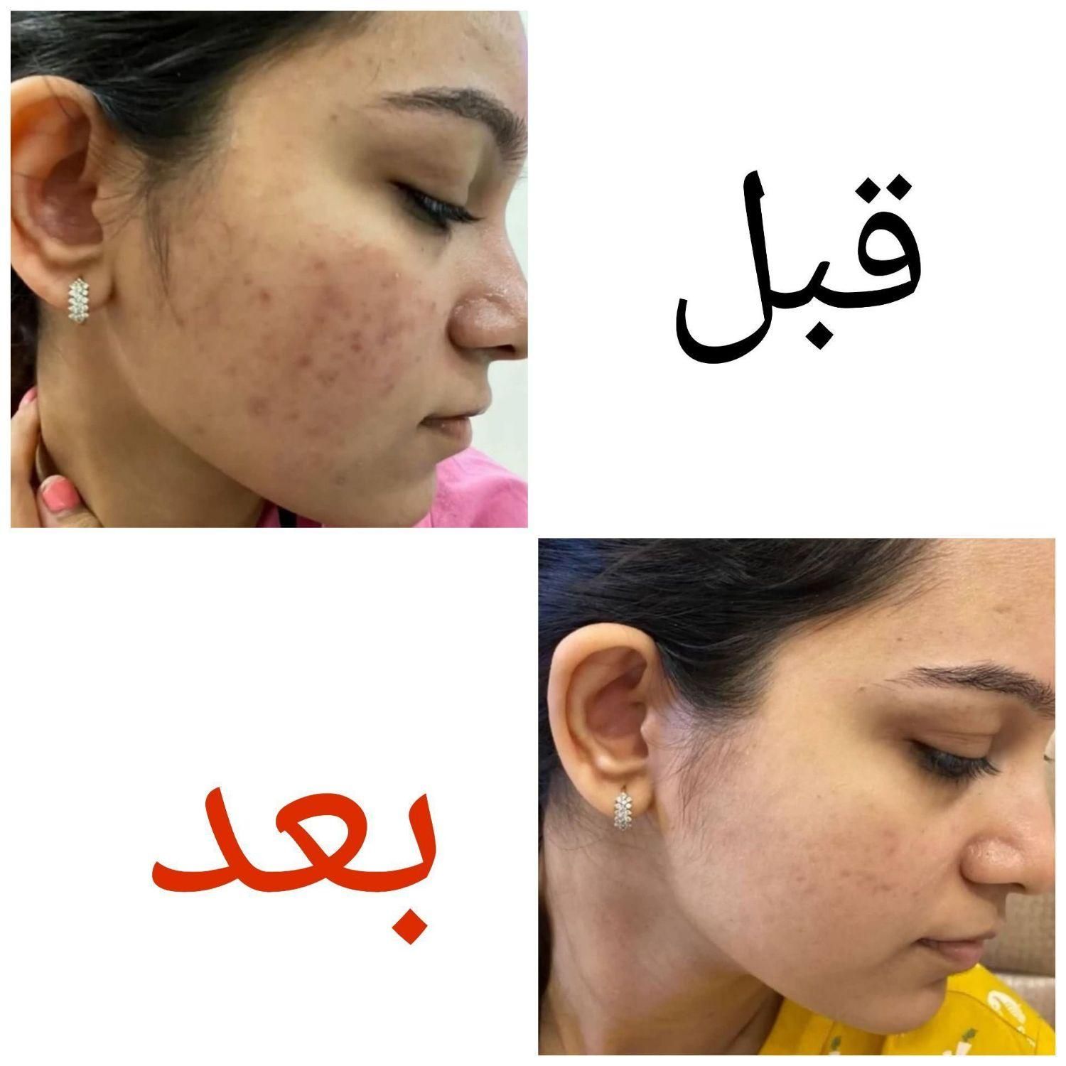 محصولات پوستی|آرایشی، بهداشتی، درمانی|مشهد, شهرک ابوذر|دیوار