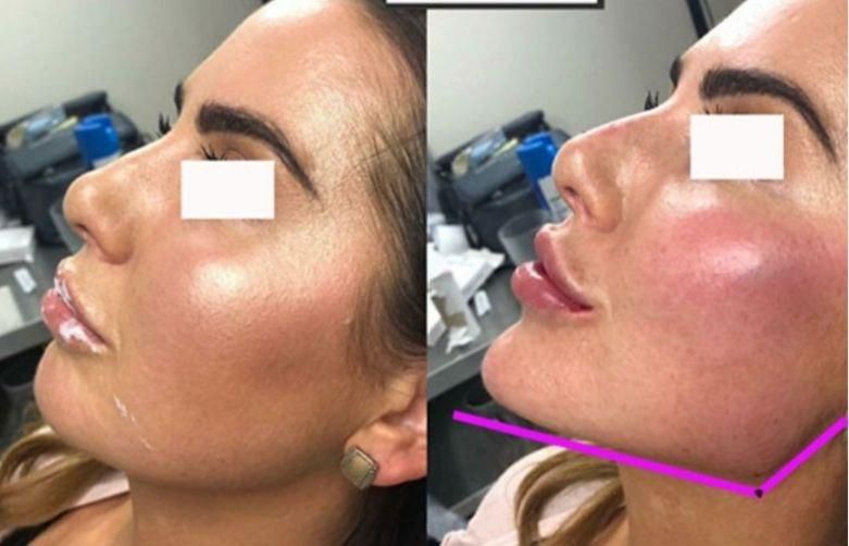 تزریق ژل و بوتاکس و کاشت نخ در کلینیک زیبایی|خدمات آرایشگری و زیبایی|خرم‌آباد, |دیوار