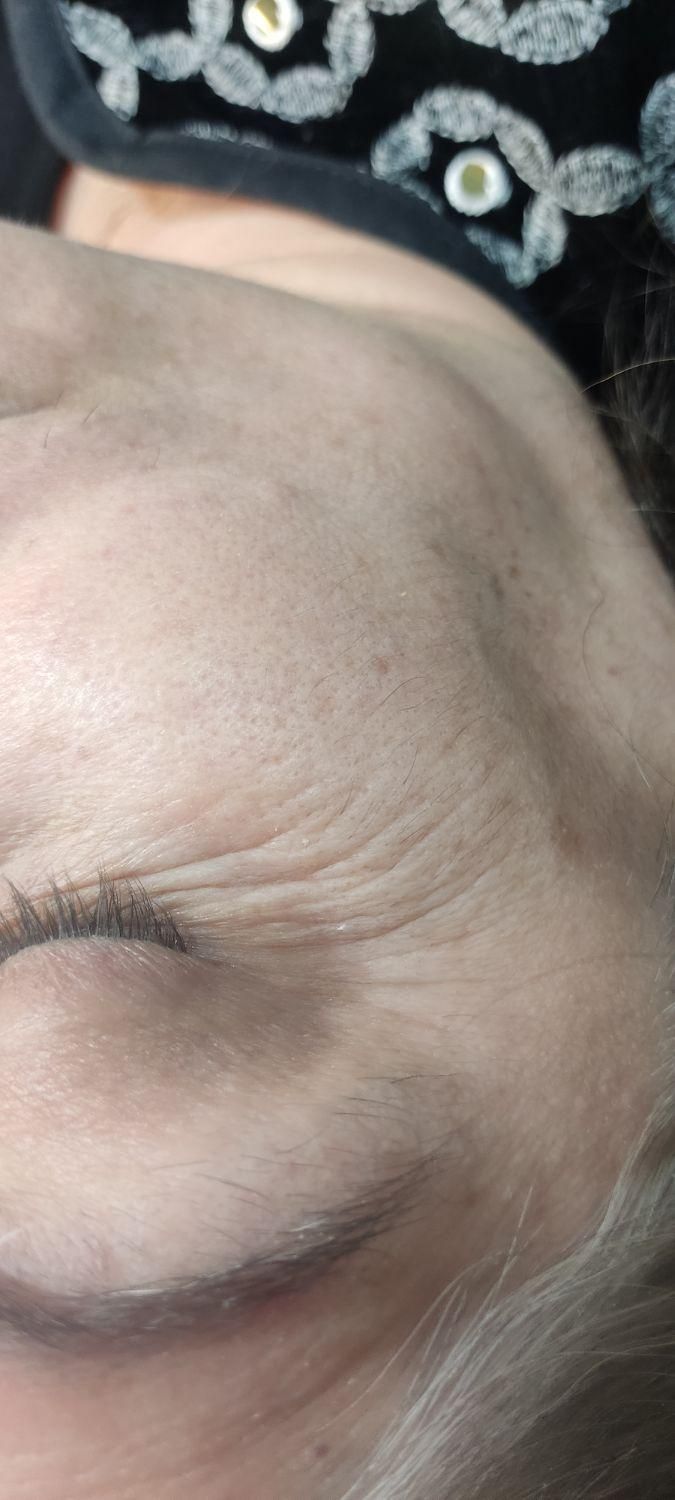 مدل پاکسازی و فیشال پوست با ۴ سال سابقه کار|خدمات آرایشگری و زیبایی|مشهد, صیاد شیرازی|دیوار