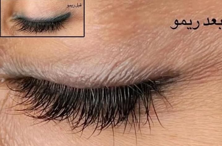 ریمو تتو،ریموو ابرو|خدمات آرایشگری و زیبایی|مشهد, صیاد شیرازی|دیوار