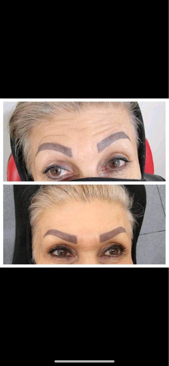 جشنواره نوروزمدل ژل وبوتاکس هایفو تراپی مزوتراپی ‌|خدمات آرایشگری و زیبایی|تهران, تهرانپارس شرقی|دیوار