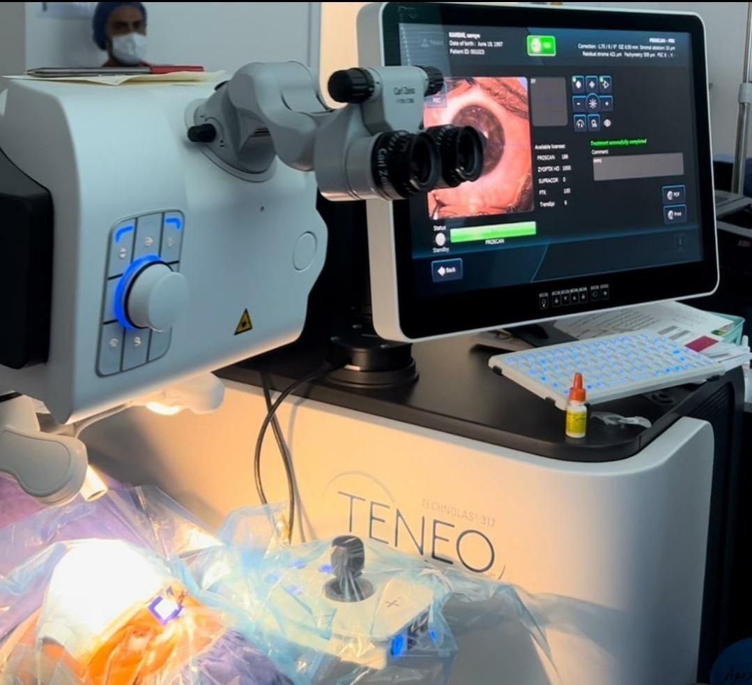 عمل لیزیک لازک prk فمتو با دستگاه۲۰۲۲|خدمات آرایشگری و زیبایی|تهران, دربند|دیوار