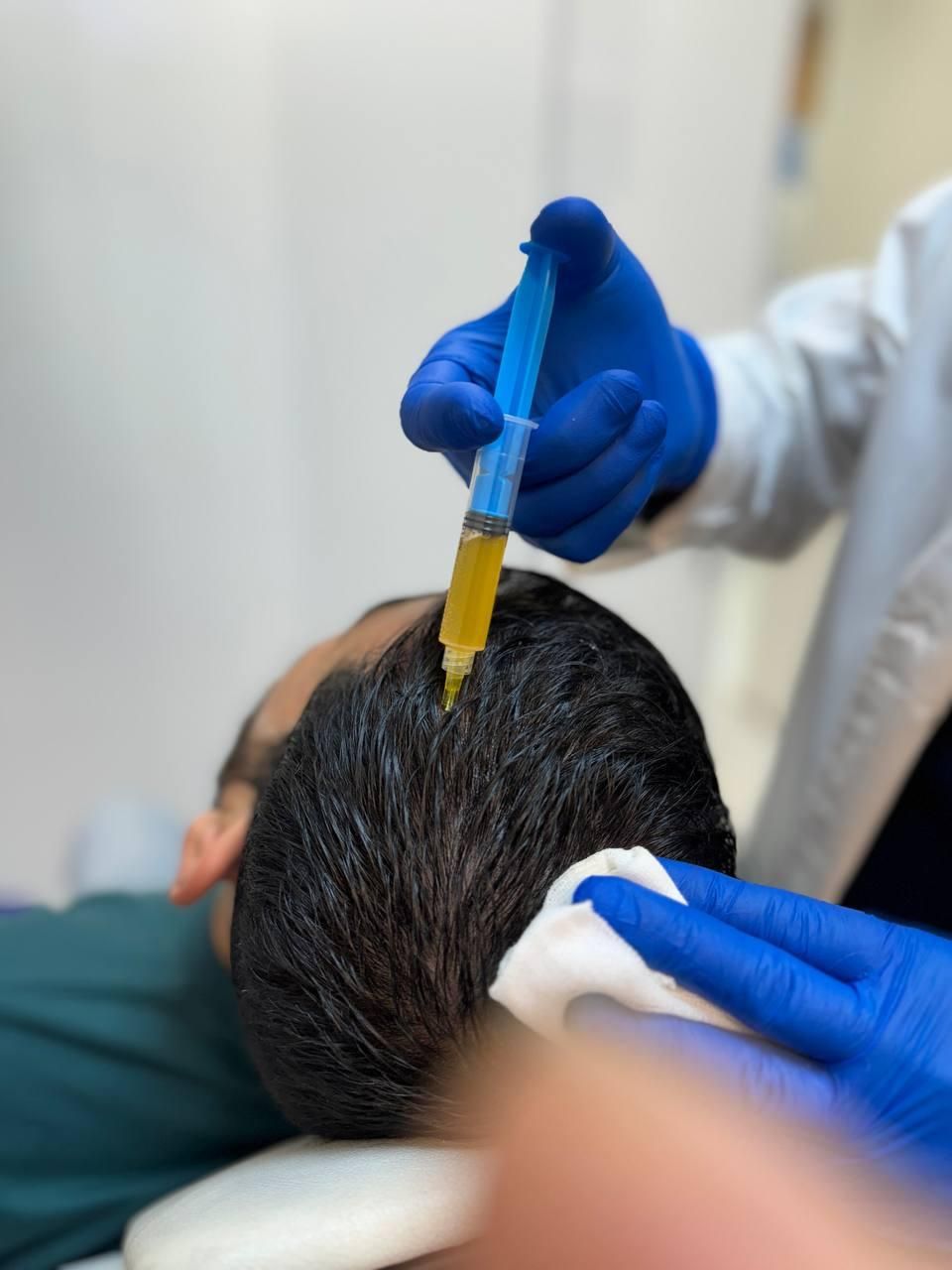 پی ار پی مو،صورت،اگزوزوم،مزوتراپی،هیرفیلر PRP|خدمات آرایشگری و زیبایی|تهران, هفت حوض|دیوار