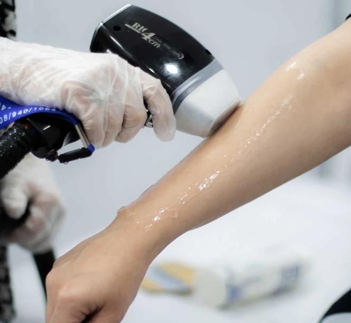 آفر ویژه یلدانه لیزر موی زائد (ایرانا)|خدمات آرایشگری و زیبایی|یاسوج, |دیوار