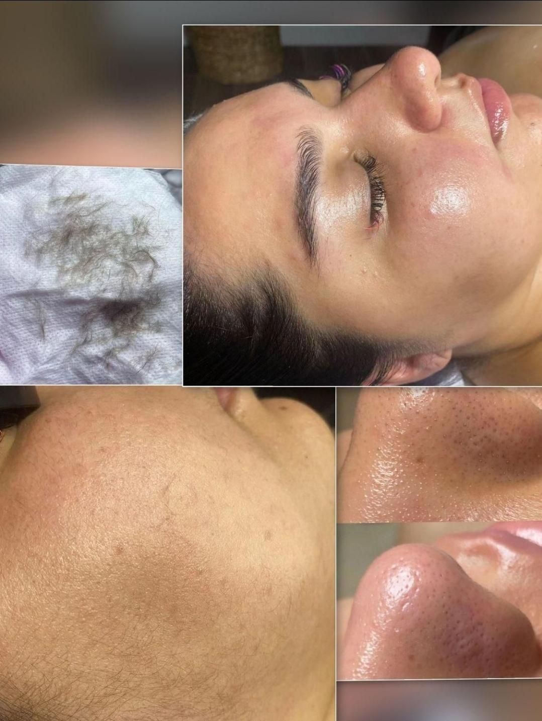 فیشال و پاکسازی پوست|خدمات آرایشگری و زیبایی|اصفهان, خواجو|دیوار