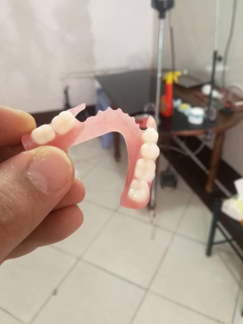 دندانسازی ساخت دندان مصنوعی|خدمات آرایشگری و زیبایی|تهران, اکباتان|دیوار