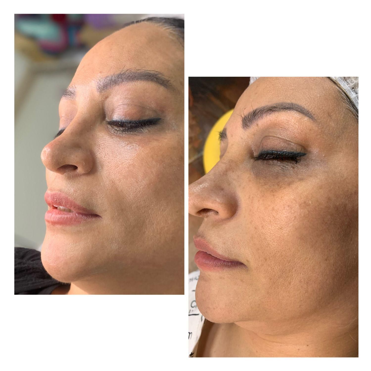 فیشیال و آبرسانی تخصصی/ خدمات و آموزش|خدمات آرایشگری و زیبایی|کرج, فاز ۲ مهرشهر|دیوار