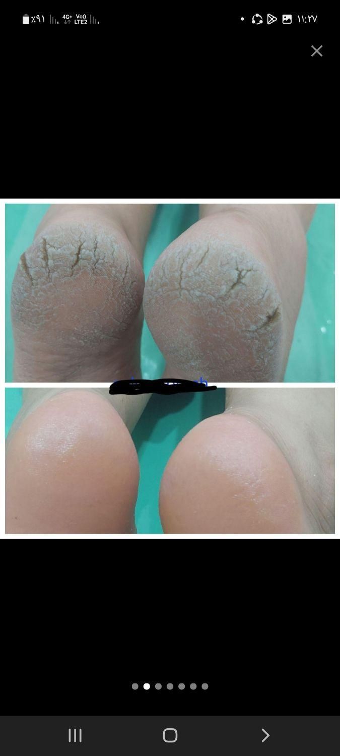 اپلاسیون تخصصی. پارافین. پاکسازی ومژه وناخن|خدمات آرایشگری و زیبایی|اهواز, گلستان|دیوار